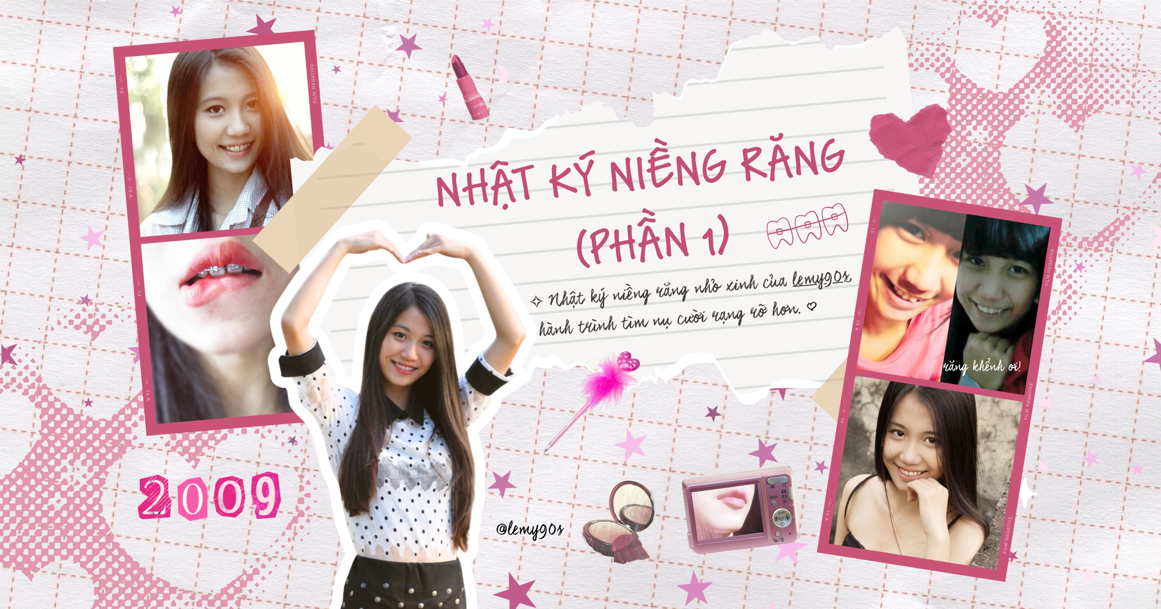 Nhật ký niềng răng (phần 1): Có nên niềng răng không?